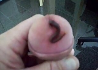 Dude lets a worm slide inside his urethra so it can live down there